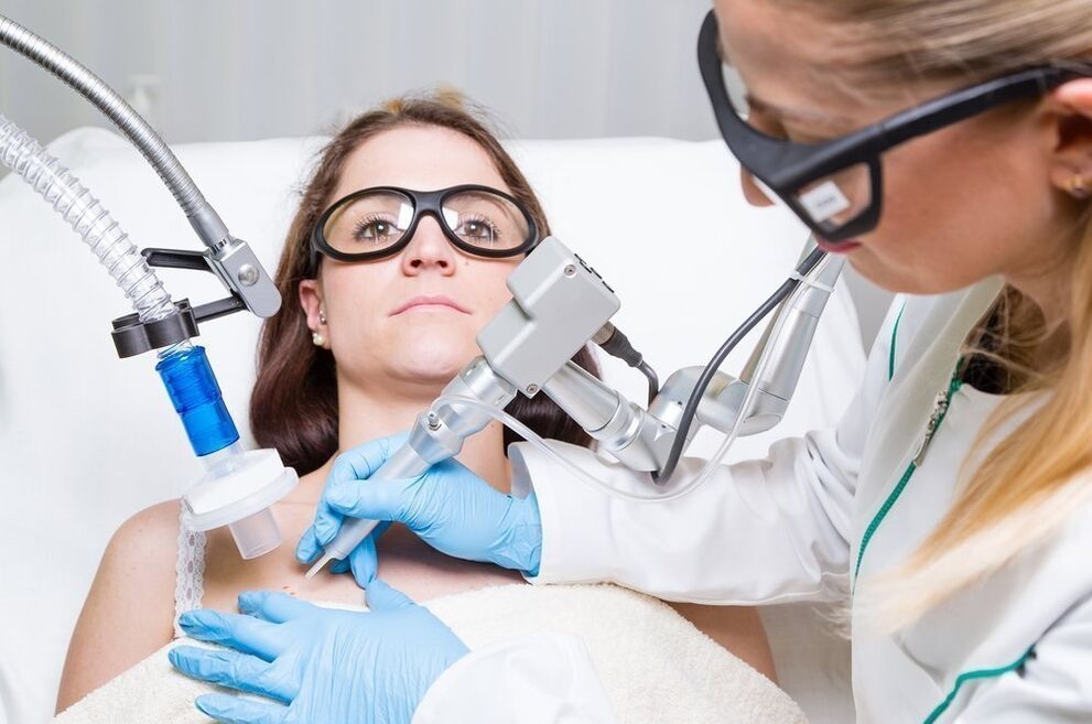 Wart treatment