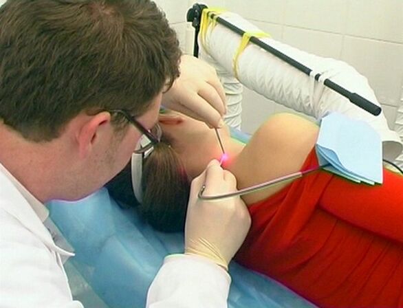 Papilloma elimination