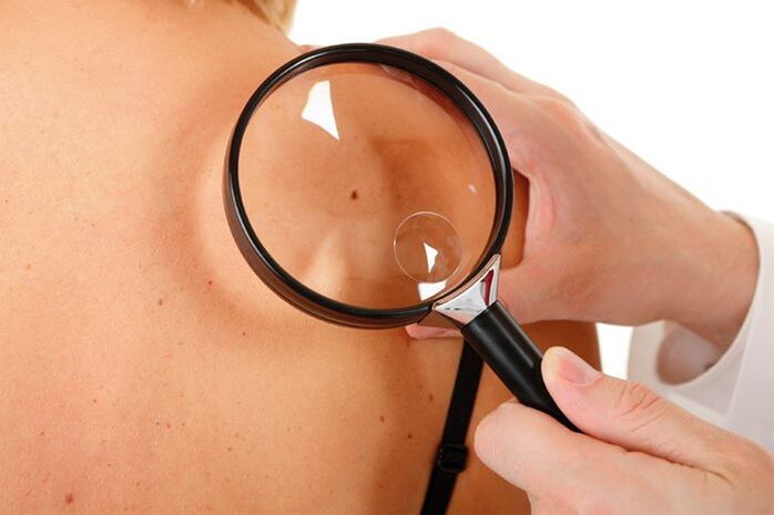 Examination of a patient with HPV.